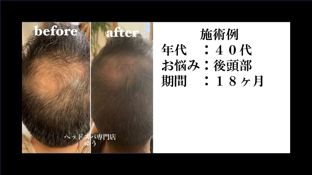 Before & After 2