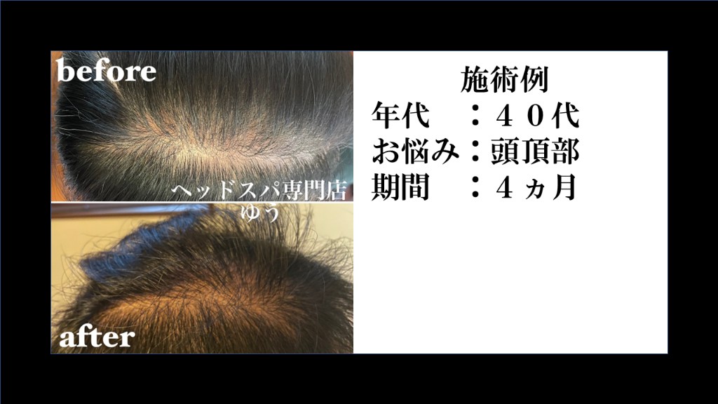 Before & After 13