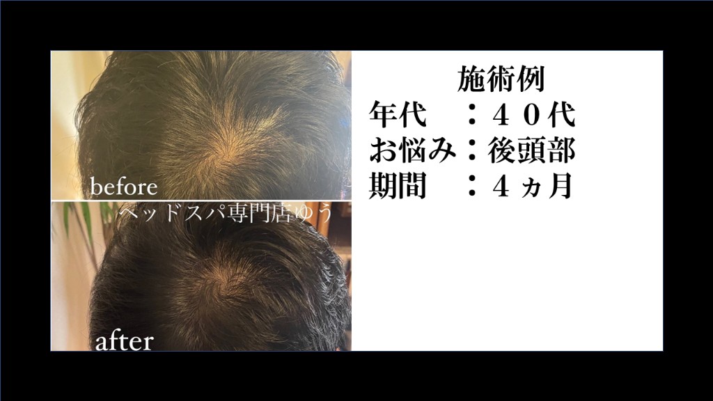 Before & After 18